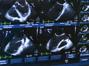 ultrasound-509396_1920 (1).png